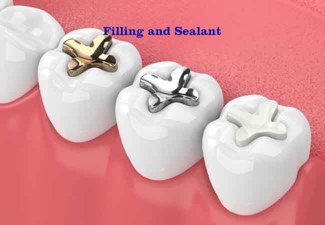Cosmetic Fillings