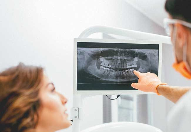 Dental Scanner and RVG